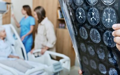 Maladie de Parkinson : un nouvel appareil à ultrasons permettrait d’en réduire les symptômes